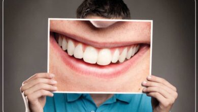 What are the Benefits of Smile Design?