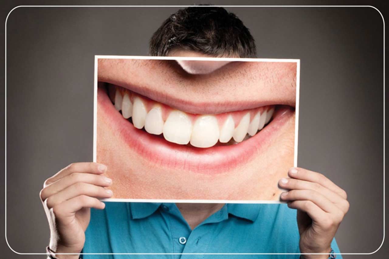 What are the Benefits of Smile Design?