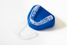 Dos and Don’ts with Clear Aligners