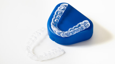 Dos and Don’ts with Clear Aligners