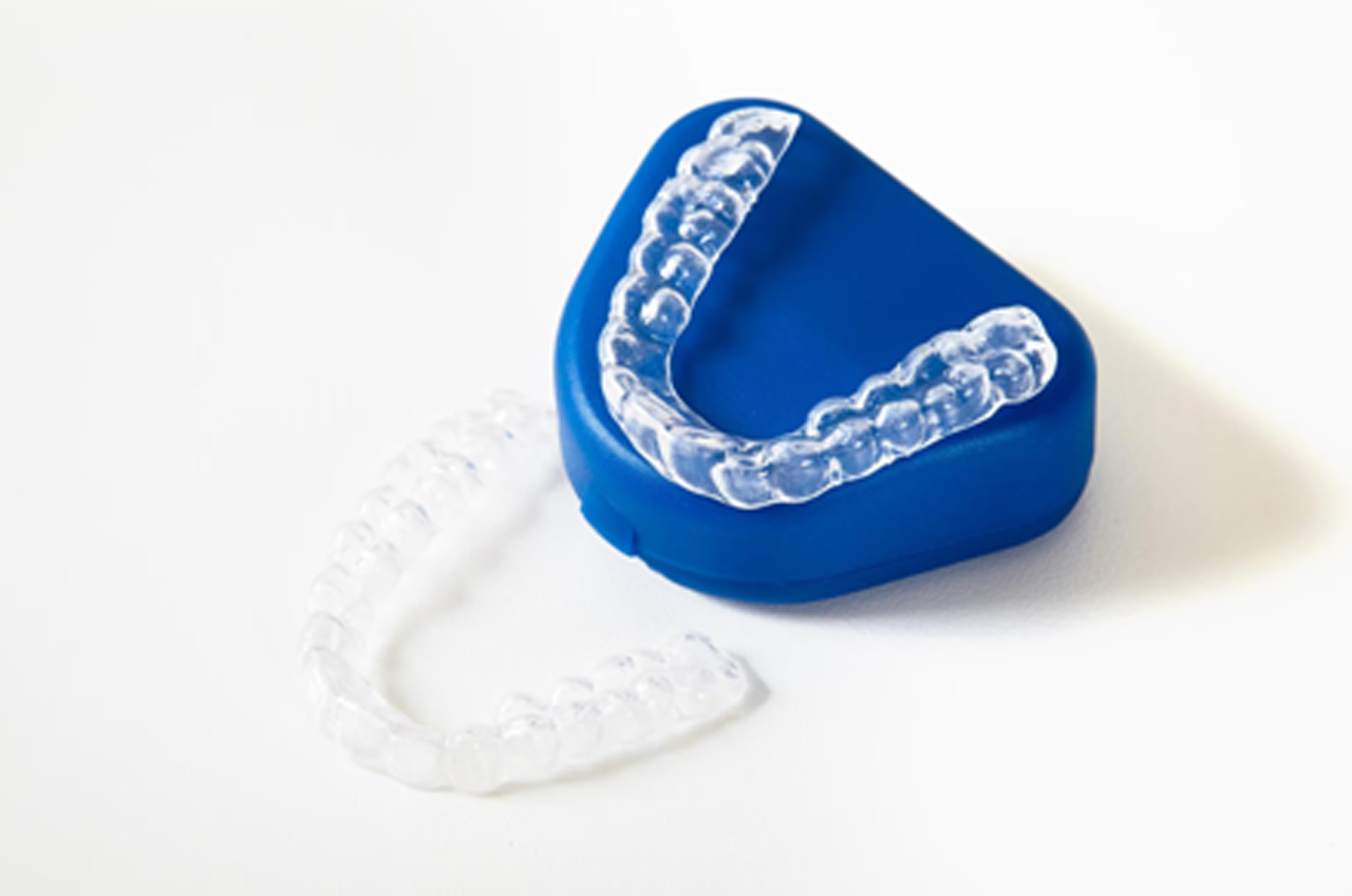 Dos and Don’ts with Clear Aligners